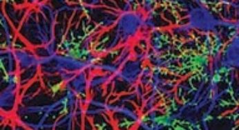 Helping a Brain in Pain